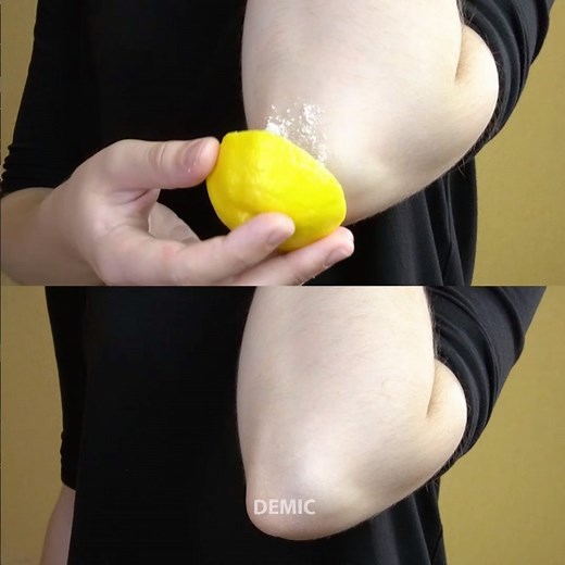 4.2M views · 2.3K reactions | Natural ways to lighten dark knees and elbows | DEMIC | Facebook