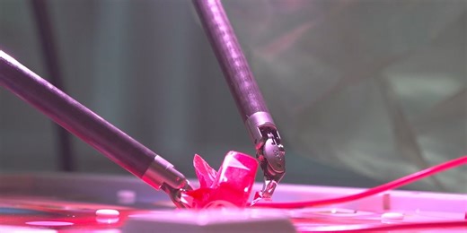 New surgical robot providing minimally invasive surgeries makes debut in local hospital