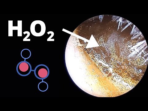 How HYDROGEN PEROXIDE Ear Drops Work (Ear Wax Removal)