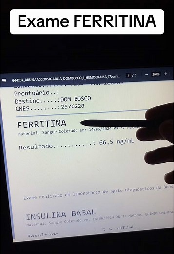 Exame de Ferritina: Níveis e Importância