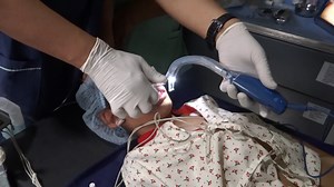 Pediatric Intubation Video - PatwaShah i-1