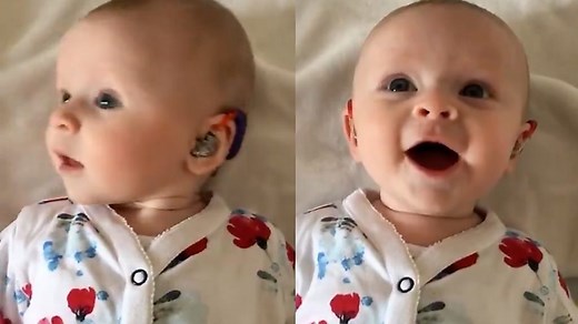 聴覚障害の赤ちゃんが補聴器をつけた瞬間 - BBCニュース