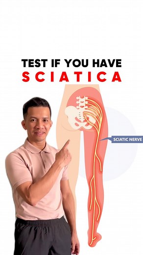 165K views · 3K reactions | 3 test to know if you have SCIATICA. | Physical Therapy Session | Facebook
