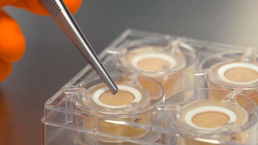 Down to Earth - Recycling human skin: An alternative to animal testing?