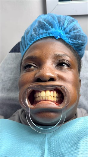 Teeth whitening in Accra ❤️🔥 @Beauty Gist💅❤️💄 #laserteethwhitening #brightersmile #teethwhitening