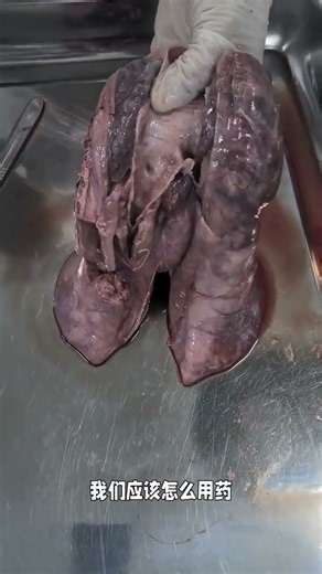 Bronchial mucus examination should focus on whether there is mucus or not#Prevention a