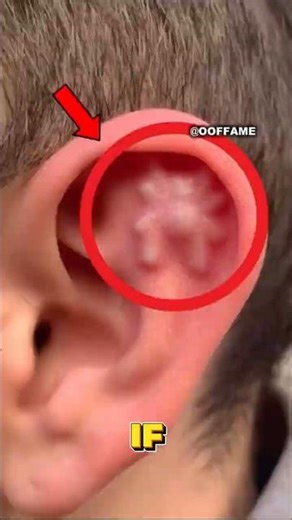 Spider Under the Skin? It’s Actually Fake 😳 #shorts