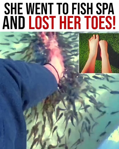 Fish spas and pools have safety signs for a reason. Always read them before you dive in. | Project Nightfall