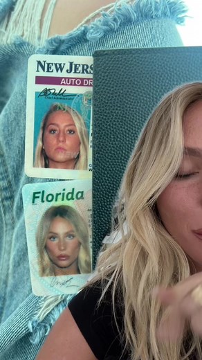 For anyone wondering: puberty, lip fillers, and stopping the chronic side part