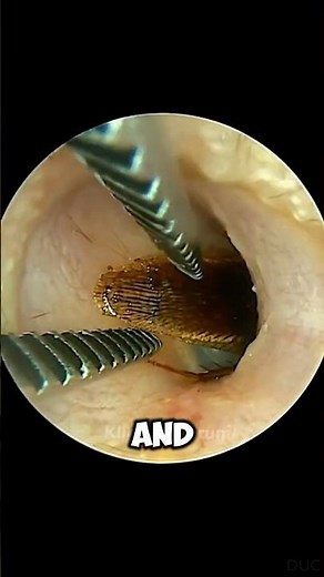 You've Been Cleaning Your Ears WRONG! 🛑