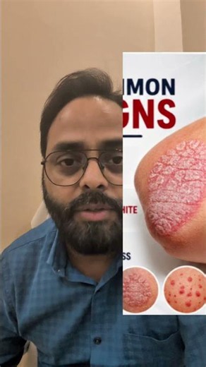 Psoriasis Lesions Explained | Symptoms, Causes & Treatment | Dr PVS Bhadauria