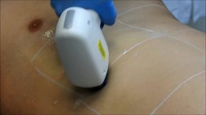 50K views · 29 reactions | Thinking of investing in an IPL or SHR machine? How much would your clinic grow if you had all the tools, training and support that you need to crush your competition with your IPL/SHR services? What if you get full support and follow in the footsteps of some of Australias most successful beauty clinics? Let’s grow together. | Spectrum Science & Beauty | Facebook