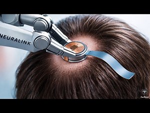 Elon Musk’s Neuralink 2026: 1,000 Trial Brain Chip for Patients Using Tesla AI Robots