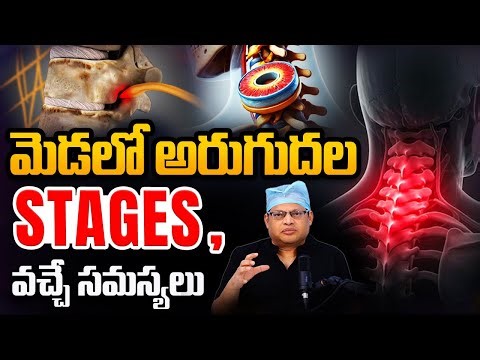 What is the cause of neck pain? | Cervical spondylosis treatment | Neck pain | Dr GPV Subbaiah
