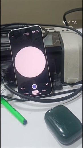 Otoscope examination #eardrum #ent #audiologist