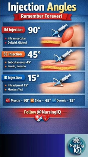 Angles of injection #shorts #shortsfeed