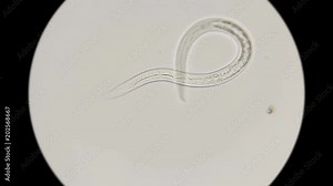 the nematode worm under a microscope