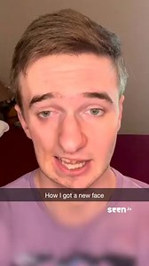 1.6K views · 17 reactions | I Got A Face Transplant “My surgeon is going to take a muscle out of my leg and transplant it into my face.” Lukas's immune system has been attacking his face since he was 7 years old. After 13 years of treatments, he's finally getting the last surgery that he needs to restore his face. | Lukas Caldwell | Facebook