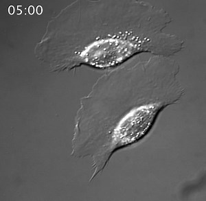 File:Gleevec-an-Abl-Family-Inhibitor-Produces-a-Profound-Change-in-Cell-Shape-and-Migration-pone.0052233.s007.ogv - Wikimedia Commons