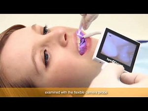 Intraoral camera---- iO1 Pro from SyncVision