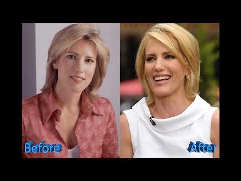 Laura Ingraham Plastic Surgery: Nothing More Than A Gossip