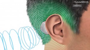 See how AdHear hearing aid device works for people hard of hearing