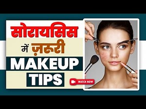 Makeup Tips for Psoriasis Patients | Tips to Cure Psoriasis on Face | Psoriasis Specialist Care