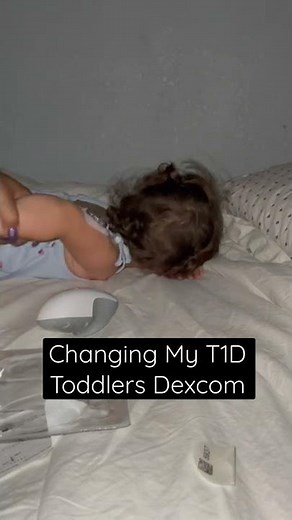 Dexcom Sensor Change on My Diabetic Toddler While She Sleeps
