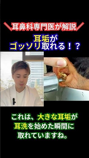 [Explained by an ENT specialist] The moment you can remove "large earwax" with ear washing! Cause...