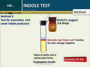 Indole test