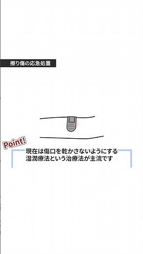 擦り傷の応急処置方法