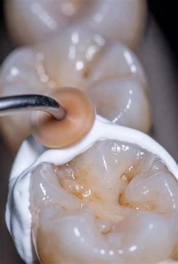 Teeth Cleaning and Dental ASMR Experience