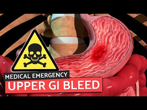 Upper GI Bleeds for Medical/PA Finals | Medical Emergencies Made Easy
