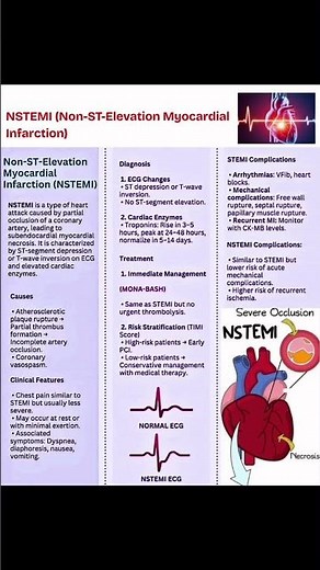 NSTEMI ( NON-ST-Elevation myocardial infraction )