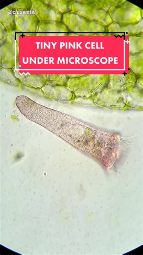 Exploring the Microscopic World: Stentor Igneus Ciliate Discovery