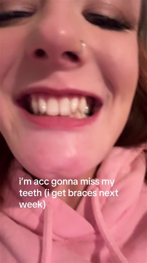 Understanding Dental Spacers for Braces