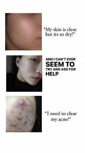 Clear Skin Trend: Crying in My Prom Dress