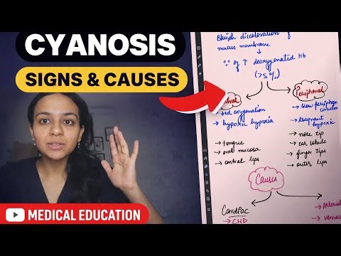 Cyanosis Explained in 5 Minutes | Causes, Types & Clinical Signs
