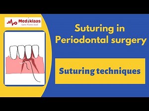Suturing in Periodontal Surgery l Suturing techniques l Wound suturing l Mediklaas