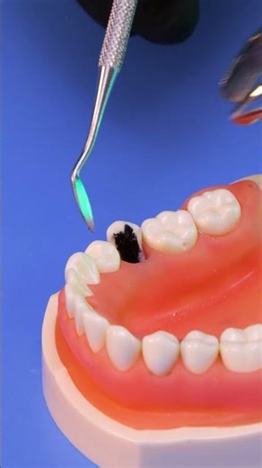 Ever Wondered How Dentists Pull Teeth? Here’s the Breakdown 😁