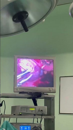 Removing a cystocele. #nursing #surgeryinstruments #hospital #nurse #doctor ##surgery