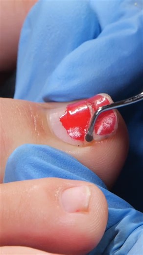 Erica's 💅 Nail Tools & Tips on Instagram: "WWYD? 👀 Comment below and I'll send you the full tutorial! #nailtech #pedicure #toenails"