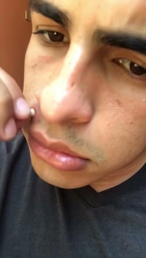 Extracción de grano enorme