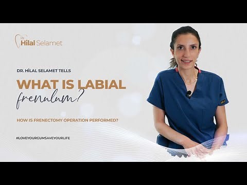 What is Labial Frenulum? How is Frenectomy Operation Performed?