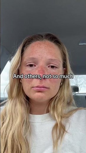Living with MS Looks Like This