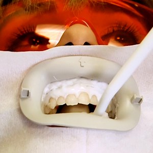 From gum contouring to teeth whitening, these four procedures can reinvent your smile. | Insider Beauty