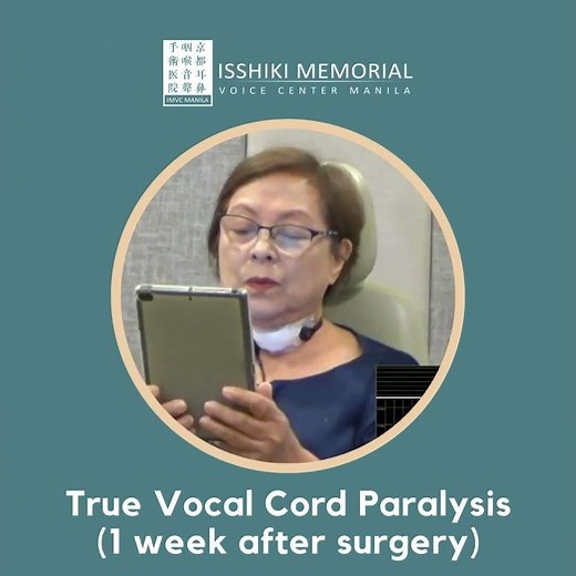 Before and After - True Vocal Cord Paralysis Surgery