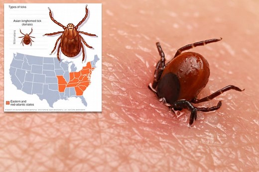 Potentially deadly bacteria found in invasive tick for first time in US