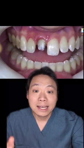 Making a Temporary Crown at Home: Dental Tips