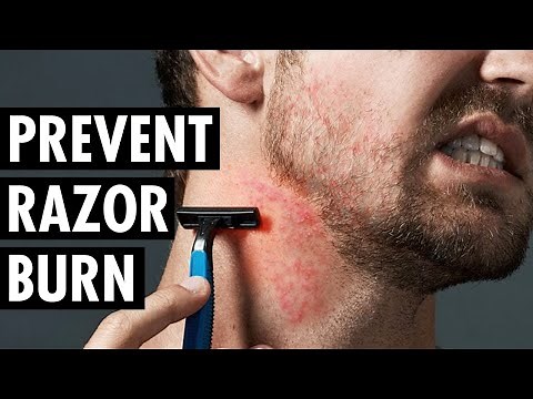 How to Stop Getting Razor Burn | What Causes Razor Burn? | Tiege Hanley